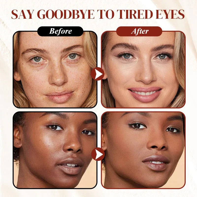 🔥 LAST DAY PROMOTION - BUY 1 GET 1 FREE ✨Colored Clay Undereye Corrector