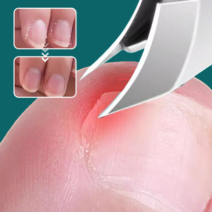 🔥Hot Sale 50%🔥 Anti-Splash 25° Slant Edge Nail Clipper 3-Piece Set